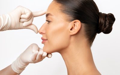 Rinoplastia: cirurgia estética e funcional do nariz
